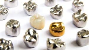 عدم درمان دندان شکسته کودک