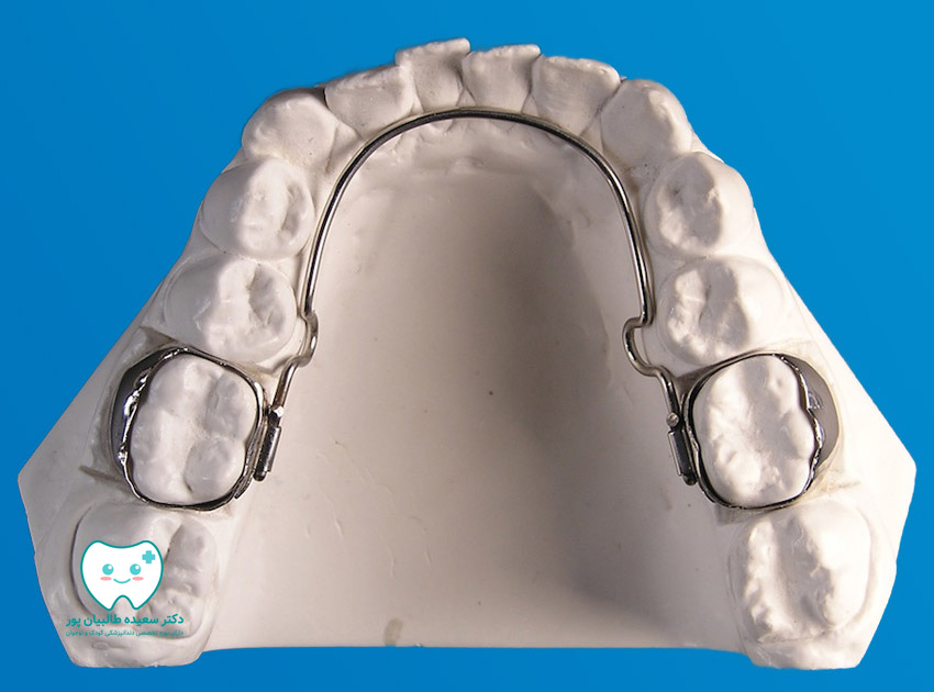 فضا نگهدارنده دندان برای کودک شما