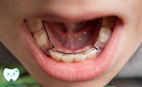 اگر از فضا نگهدارنده استفاده نکنیم چه اتفاقی می‌افتد؟